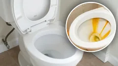 O calcário acumulado no WC desapareceu graças a uma mistura caseira de 3 ingredientes